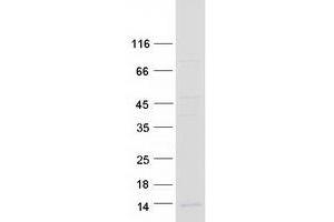 Validation with Western Blot