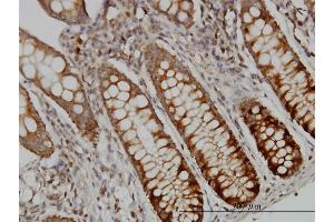 Immunoperoxidase of monoclonal antibody to DUT on formalin-fixed paraffin-embedded human colon.