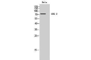 Western Blotting (WB) image for anti-Adrenergic, Beta, Receptor Kinase 1 (ADRBK1) (Ser129) antibody (ABIN3175426) (GRK2 anticorps  (Ser129))