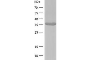 Western Blotting (WB) image for phosphoribosyl Pyrophosphate Synthetase-Associated Protein 2 (PRPSAP2) (AA 1-369) protein (His-IF2DI Tag) (ABIN7124442)