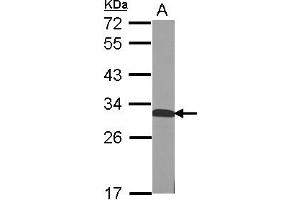 Image no. 1 for anti-Quinoid Dihydropteridine Reductase (QDPR) (AA 1-244) antibody (ABIN1501905) (QDPR anticorps  (AA 1-244))