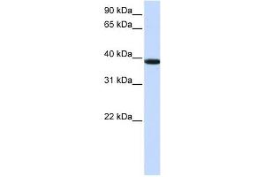 KLHDC8B antibody used at 1 ug/ml to detect target protein. (KLHDC8B anticorps  (Middle Region))