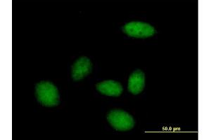 Immunofluorescence of purified MaxPab antibody to ZHX3 on HeLa cell.