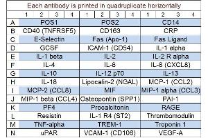 Image no. 1 for Human Immune Response Array Q1 (ABIN4956066) (Humain Immune Response Array Q1)