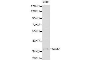 Western Blotting (WB) image for anti-SRY (Sex Determining Region Y)-Box 2 (SOX2) (AA 1-140) antibody (ABIN3021003) (SOX2 anticorps  (AA 1-140))