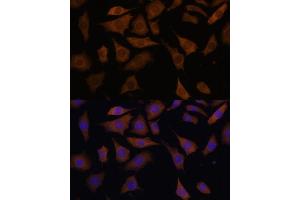 Immunofluorescence analysis of L929 cells using PGK2 Polyclonal Antibody (ABIN6128431, ABIN6145506, ABIN6145507 and ABIN6216775) at dilution of 1:100 (40x lens).