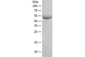 Western Blotting (WB) image for Fascin (FSCN1) (AA 1-493) protein (His tag) (ABIN7122887) (Fascin Protein (FSCN1) (AA 1-493) (His tag))