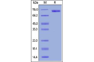 Human B7-H3 (4Ig), Fc Tag on  under reducing (R) condition.