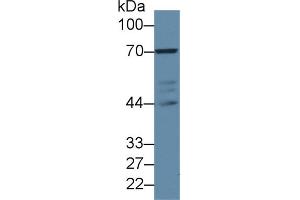 Western Blot; Sample: Human Jurkat cell lysate; Primary Ab: 2µg/ml Rabbit Anti-Mouse LCP2 Antibody Second Ab: 0. (LCP2 anticorps  (AA 202-463))