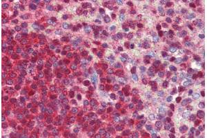 Human Spleen (formalin-fixed, paraffin-embedded) stained with NR0B2 antibody ABIN462246 followed by biotinylated goat anti-rabbit IgG secondary antibody ABIN481713, alkaline phosphatase-streptavidin and chromogen.