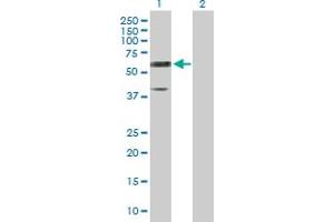 Western Blot analysis of RTN2 expression in transfected 293T cell line by RTN2 MaxPab polyclonal antibody. (Reticulon 2 anticorps  (AA 1-472))