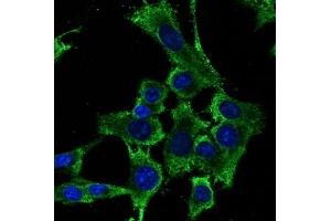 Immunofluorescence (IF) image for anti-Ribosomal Protein S6 (RPS6) (C-Term) antibody (ABIN1440052)