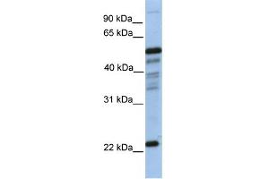 WB Suggested Anti-PGDS Antibody Titration:  0. (PTGDS anticorps  (N-Term))