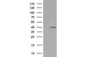 Image no. 2 for anti-Mitogen-Activated Protein Kinase Kinase 3 (MAP2K3) antibody (ABIN1499409) (MAP2K3 anticorps)