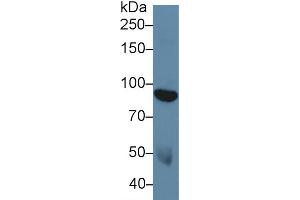 Western blot analysis of Human Serum, using Human DDR1 Antibody (5 µg/ml) and HRP-conjugated Goat Anti-Rabbit antibody ( (DDR1 anticorps  (AA 568-829))
