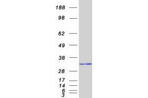 Validation with Western Blot