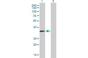 Western Blot analysis of ZNF124 expression in transfected 293T cell line by ZNF124 MaxPab polyclonal antibody. (ZNF124 anticorps  (AA 1-289))