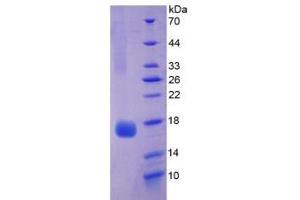 SDS-PAGE of Protein Standard from the Kit (Highly purified E. (Myoglobin Kit CLIA)