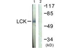 Western blot analysis of extracts from Jurkat cells, using Lck (Ab-505) Antibody. (LCK anticorps  (AA 460-509))