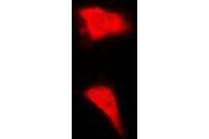 Immunofluorescent analysis of BORIS staining in MCF7 cells.