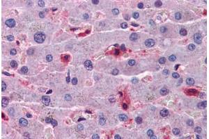 Human Liver: Formalin-Fixed, Paraffin-Embedded (FFPE) (Hepcidin anticorps  (AA 25-85))
