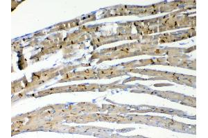 IHC analysis of beta Catenin using anti-beta Catenin antibody .