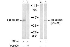 Image no. 2 for anti-Nuclear Factor of kappa Light Polypeptide Gene Enhancer in B-Cells Inhibitor, epsilon (NFKBIE) (Ser22) antibody (ABIN197570) (NFKBIE anticorps  (Ser22))