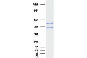 Validation with Western Blot
