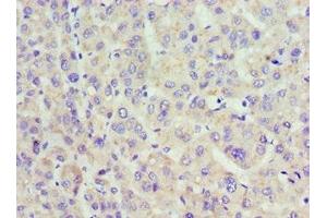 Immunohistochemistry of paraffin-embedded human placenta tissue using ABIN7158557 at dilution of 1:100