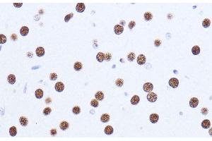 Immunohistochemistry of paraffin-embedded Mouse brain using MATR3 Polyclonal Antibody at dilution of 1:100 (40x lens).
