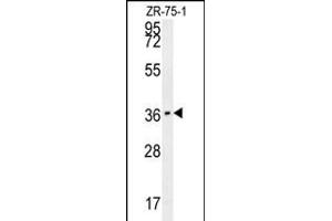 CLEC12A Antibody (Center) (ABIN653995 and ABIN2843932) western blot analysis in ZR-75-1 cell line lysates (35 μg/lane). (CLEC12A anticorps  (AA 178-206))