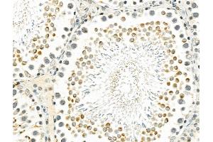 ABIN7094329 and ABIN7098376 at 1/100 staining Rat testis tissue by IHC-P.