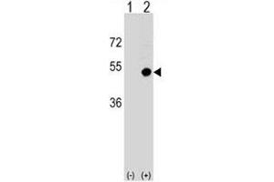 Western blot analysis of CD1d antibody and 293 cell lysate (2 ug/lane) either nontransfected (Lane 1) or transiently transfected (2) with the CD1D gene.