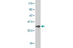 Western Blot detection against Immunogen (37.