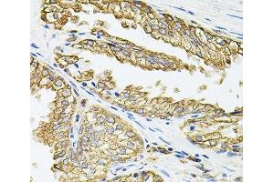 Immunohistochemistry of paraffin-embedded Human prostate using HLA-DQA1 Polyclonal Antibody at dilution of 1:100 (40x lens). (HLA-DQA1 anticorps)