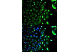 Immunofluorescence analysis of HeLa cells using RAB5A antibody. (RAB5 anticorps)