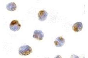 Immunohistochemistry (IHC) image for anti-Induced Myeloid Leukemia Cell Differentiation Protein Mcl-1 (MCL1) (Middle Region) antibody (ABIN1030997) (MCL-1 anticorps  (Middle Region))