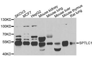 Western blot analysis of extracts of various cell lines, using SPTLC1 antibody. (SPTLC1 anticorps  (AA 37-310))