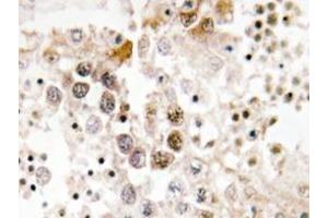 Immunohistochemistry analyzes of FoxL1 antibody in paraffin-embedded human testis tissue.