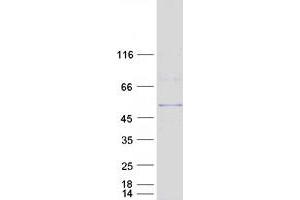 Validation with Western Blot