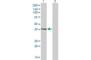 Western Blot analysis of RAD51C expression in transfected 293T cell line by RAD51C monoclonal antibody (M01), clone 3F3-5C6.