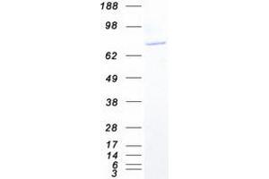 Validation with Western Blot
