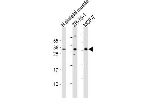 All lanes : Anti-FGF17 Antibody (N-Term) at 1:2000 dilution Lane 1: human skeletal muscle lysates Lane 2: ZR-75-1 whole cell lysates Lane 3: MCF-7 whole cell lysates Lysates/proteins at 20 μg per lane. (FGF17 anticorps  (AA 78-112))
