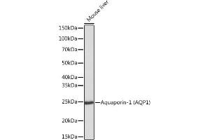 Western blot analysis of extracts of Mouse liver, using Aquaporin-1 (Aquaporin-1 ) Rabbit mAb (ABIN1682901, ABIN3018679, ABIN3018680 and ABIN7101646) at 1:1000 dilution. (Aquaporin 1 anticorps)