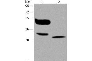 Western Blot analysis of A375 cell and Human lung cancer tissue using MAGEA8 Polyclonal Antibody at dilution of 1:400 (MAGEA8 anticorps)