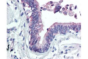 Anti-CLIC4 antibody IHC of human lung. (CLIC4 anticorps  (N-Term))
