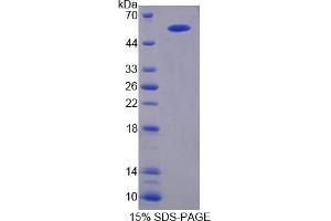 Image no. 1 for Amyloid beta (A4) Precursor Protein-Binding, Family B, Member 1 Interacting Protein (APBB1IP) (AA 188-421) protein (His tag,GST tag) (ABIN6238361) (Amyloid beta (A4) Precursor Protein-Binding, Family B, Member 1 Interacting Protein (APBB1IP) (AA 188-421) protein (His tag,GST tag))