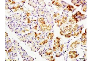 Immunohistochemistry (Paraffin-embedded Sections) (IHC (p)) image for anti-2',3'-Cyclic Nucleotide 3' phosphodiesterase (CNP) (AA 151-250) antibody (ABIN730738)