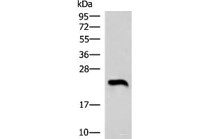 Western blot analysis of Human heart tissue lysate using NEUROG3 Polyclonal Antibody at dilution of 1:1000 (Neurogenin 3 anticorps)