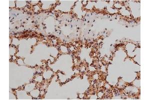 ABIN6267333 at 1/200 staining Mouse lung tissue sections by IHC-P. (SP1 anticorps  (pThr453))